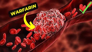 The Ultimate Guide to Understanding Warfarin Its Benefits and side effects [upl. by Susana]