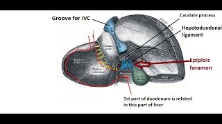 Epiploic foramen  easy and brief description [upl. by Alethia]