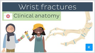 Forearm fractures Wrist fractures  Clinical Anatomy  Kenhub [upl. by Gussi]