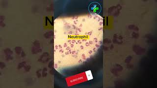 High neutrophil count in peripheral smear  neutrophils  CBC  Causes of Neutrophilia  hematology [upl. by Steinway]