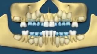 MANTRA TO REGROW TEETH [upl. by Macario]