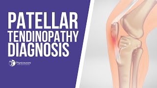 How to Diagnose Patellar Tendinopathy  Jumpers Knee Diagnosis [upl. by Adamo263]