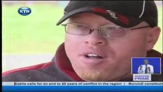 Campaign against stigmatization of people with albinism [upl. by Hayidan]