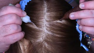 ASMR Scalp Check and Treatment Acupressure Massage Wooden Tools Scalp Massage Scalp Scratching [upl. by Eiduj]