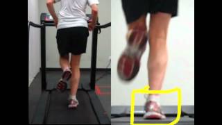 Running  RunSmart  Controlling Pronation From Your Hips [upl. by Ahtelat]