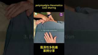 Polymyalgia Rheumatica PMR [upl. by Wandy]