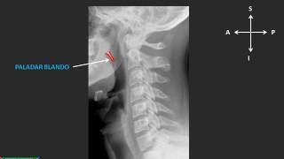 Estudio radiográfico del cuello sin audio [upl. by Fauch]