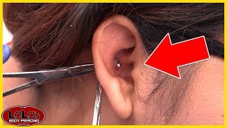 This Conch Piercing Looks BAD Removal [upl. by Brear]