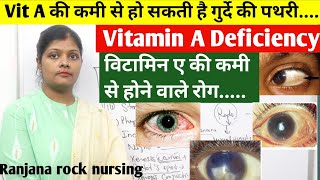 विटामिन ए की कमी से होने वाले रोग  What is vitamin A deficiency inhindi  nightblindness bitot spot [upl. by Otto353]