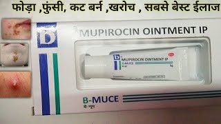 B muce ointment price b muce ointment uses bmuce ointment benefits b muce cream fayade b muce ointm [upl. by Snyder]