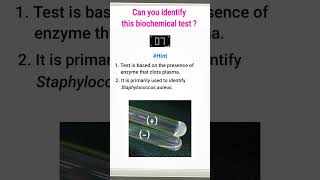 Quiz9  Biochemical test for identification of bacteria  shorts microbiology [upl. by Rutan196]