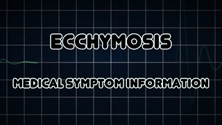 Ecchymosis Medical Symptom [upl. by Dole946]