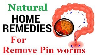 ◾How to Remove Pinworms Naturally  Home Remedies to Eliminate Pinworms [upl. by Anderegg]