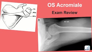 OS Acromiale Exam Review  Jay Keener MD [upl. by Toblat591]