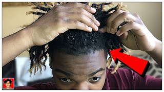 IS MY HAIRLINE RECEDING  Thinning Hair  Dreadlocks [upl. by Yevrah]