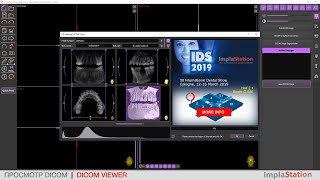 ImplaStation on IDS 2019 in Cologne [upl. by Hceicjow]