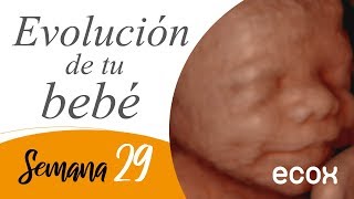 ¿Quieres ver como es un bebé de 29 semanas de gestación [upl. by Yngad]