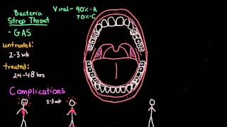 Tonsillopharyngitis Complications Diagnosis and Treatment [upl. by Esinel984]