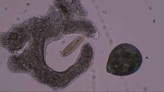 Amoeba hunts and kills paramecia and stentor to music by Lamar Genesis Winter Zimmer [upl. by Alika]