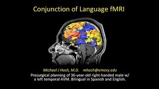 Functional MRI fMRI BOLD imaging  using conjunction display for language mapping [upl. by Onoitna555]