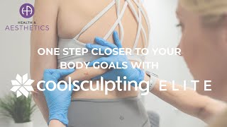 CoolSculpting Elite [upl. by Armat]