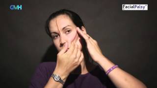 Facial Palsy DVD 1  Management of Flaccid Paralysis  Cheek Taping [upl. by Daas]