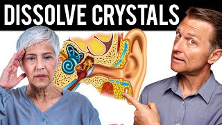 How to Dissolve Crystals in the Inner Ear and Get Rid of Vertigo [upl. by Atteragram696]