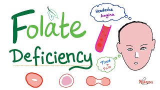 Folate deficiency  Megaloblastic Anemia  Macrocytic  Hematology Series [upl. by Aitnecserc]