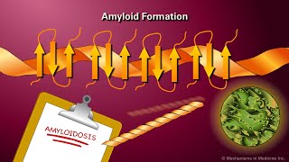 Amyloidosis [upl. by Anelehs931]