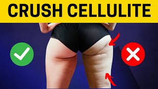 Destroy FAT amp CELLULITE From Legs in 20 Days  17 Min Workout  NO REPEAT [upl. by Garreth604]