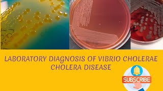 Laboratory diagnosis of Vibrio cholerae in hindi [upl. by Animehliw434]