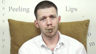 Becoming Cured from Exfoliative Cheilitis  Intro  05142012  69 [upl. by Nashoma]