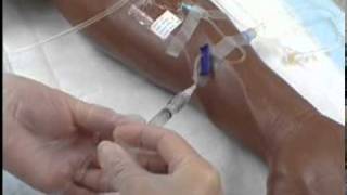 Intravenous IV Therapy Administering IV Medication via a Saline Lock [upl. by Verity]