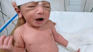 A NEWBORN ON THE CPAP MACHINE amp NEBULIZATION PROCEDURE   NICU   NEONATAL CARE [upl. by Juna]