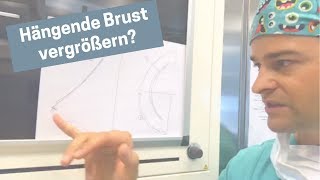 Kann ich eine hängende Brust mit Implantat vergrößern [upl. by Vilberg]