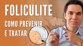 FOLICULITE Como Prevenir e Tratar [upl. by Bigot143]