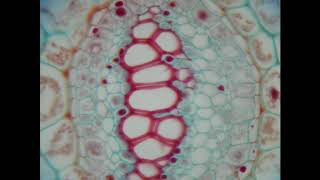 TRACHEIDS IN FERN RHIZOME [upl. by Yrtsed]