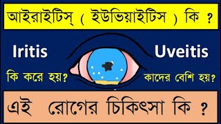 anterioruveitis iritis Iritis or Anterior uveitis symptoms signs and treatment discussed [upl. by Graff]