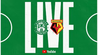 LIVE Hibernian vs Watford  PreSeason Fixture [upl. by Los775]