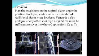 Radiographic positioning 3 Lecture 9 [upl. by Lothaire339]