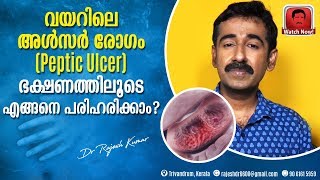 വയറിലെ അൾസർ രോഗം Peptic Ulcer ഭക്ഷണത്തിലൂടെ എങ്ങനെ പരിഹരിക്കാം [upl. by Templia]