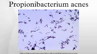 Propionibacterium acnes [upl. by Sophie]