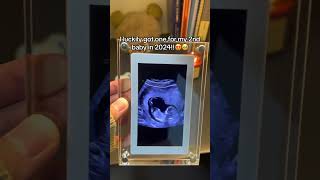 LlNK lN BlO to get your live ultrasound frame🥰😍 baby ultrasound pregnancy [upl. by Tizes669]