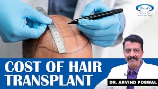 👉What is The Cost of Hair Transplant How long do Transplanted Hair last Hair Transplant In Hindi [upl. by Obrien179]