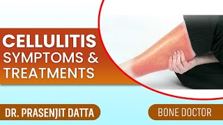 What is Cellulitis  Causes Symptoms Diagnosis and Treatment [upl. by Eilsel]