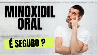 Como eu uso MINOXIDIL aplicação na prática [upl. by Anirahtak]