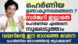 ഹെർണിയ രോഗം ഉണ്ടാകുന്നതെങ്ങനെ  സർജറി ഇല്ലാതെ Hernia എങ്ങനെ സുഖപ്പടുത്താം  Hernia Malayalam [upl. by Sabah]