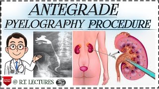 Antegrade pyelogram Antegrade pyelography procedure Alternate of IVP procedure in hindienglish [upl. by Yklam290]