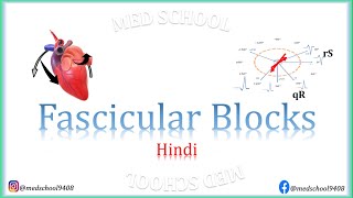 Fascicular Blocks Hindi [upl. by Aerdnaxela]