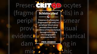 Schistocytes [upl. by Nageam]